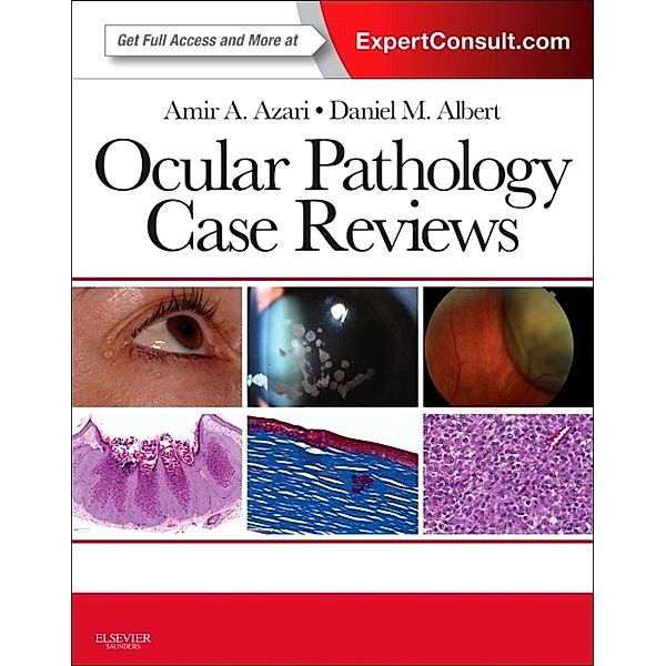 Ocular Pathology Case Reviews, Amir A. Azari, Daniel M. Albert