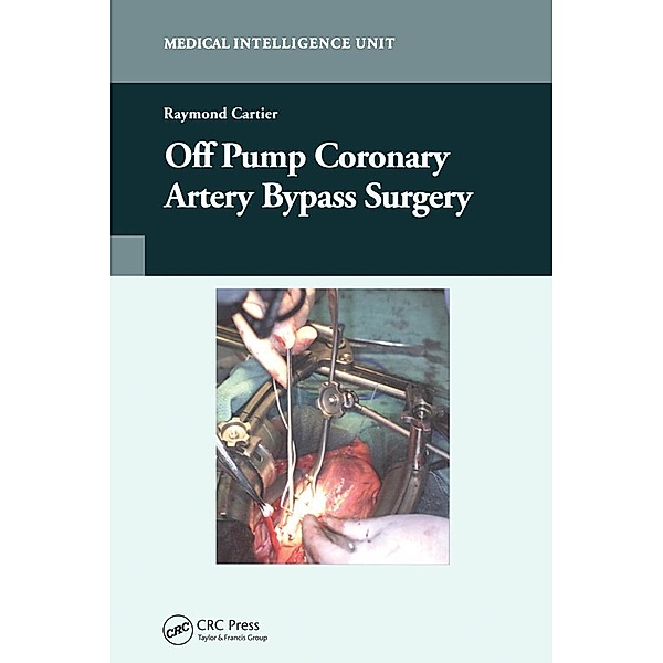 Off-Pump Coronary Artery Bypass Surgery, Raymond Cartier