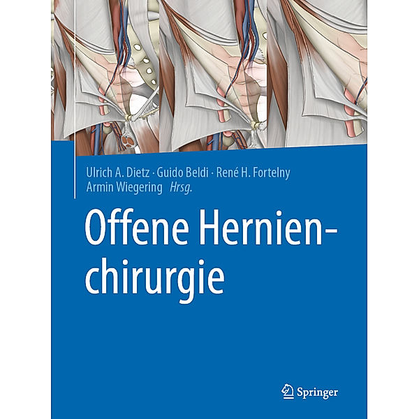 Offene Hernienchirurgie