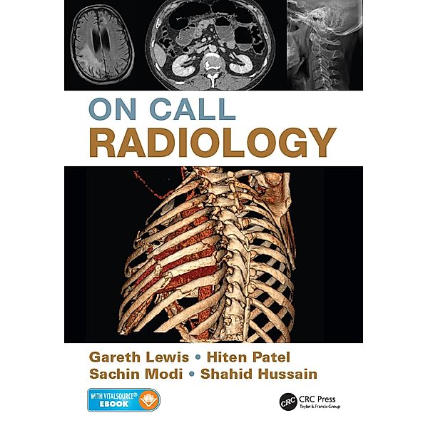 On Call Radiology, Gareth Lewis, Sachin Modi, Hiten Patel, Shahid Hussain