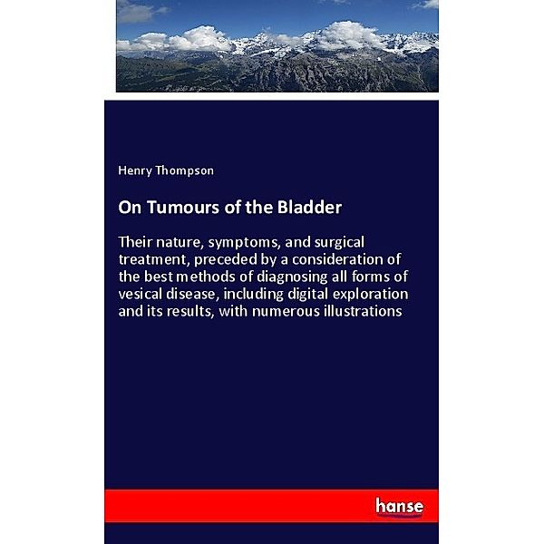 On Tumours of the Bladder, Henry Thompson