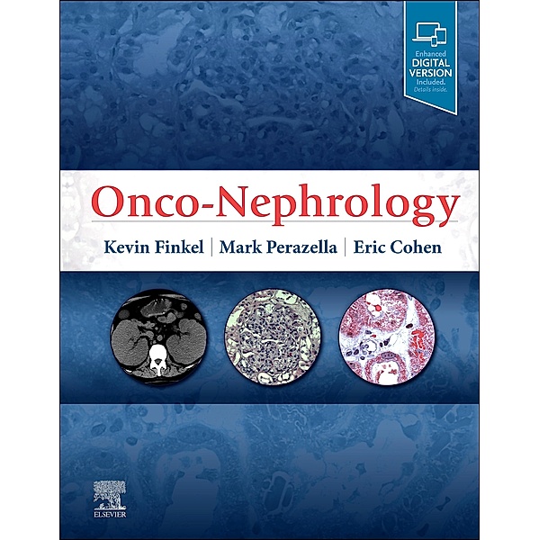Onco-Nephrology E-Book, Kevin W. Finkel, Mark Anthony Perazella, Eric P Cohen