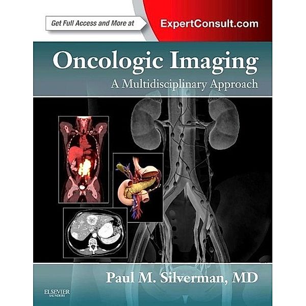 Oncologic Imaging: A Multidisciplinary Approach, Paul M. Silverman