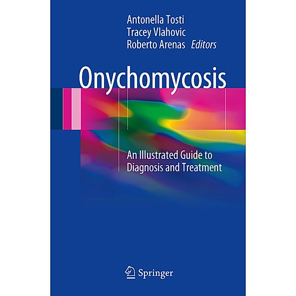 Onychomycosis