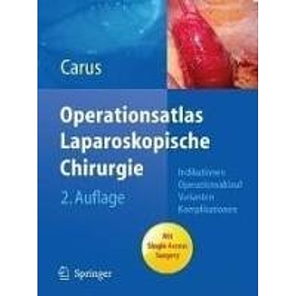 Operationsatlas Laparoskopische Chirurgie, Thomas Carus