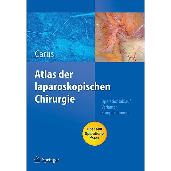 Operationsatlas Laparoskopische Chirurgie, Thomas Carus