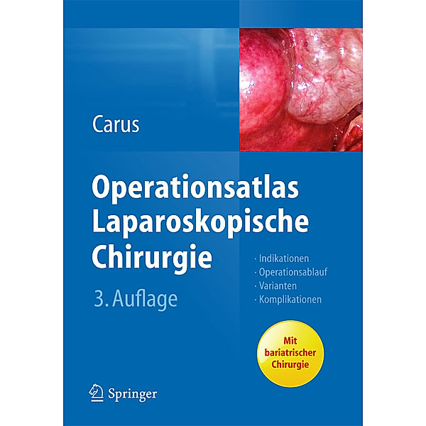 Operationsatlas Laparoskopische Chirurgie, Thomas Carus