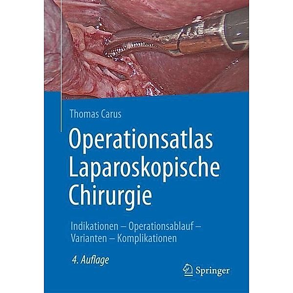 Operationsatlas Laparoskopische Chirurgie, Thomas Carus