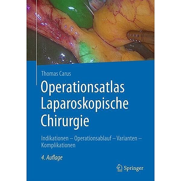 Operationsatlas Laparoskopische Chirurgie, Thomas Carus