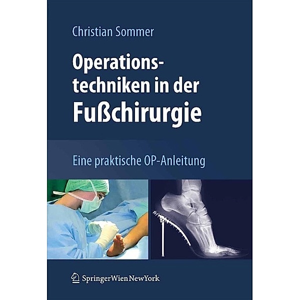 Operationstechniken in der Fusschirurgie, Christian Sommer