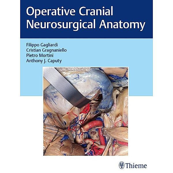 Operative Cranial Neurosurgical Anatomy, Filippo Gagliardi, Cristian Gragnaniello, Pietro Mortini, Anthony J. Caputy