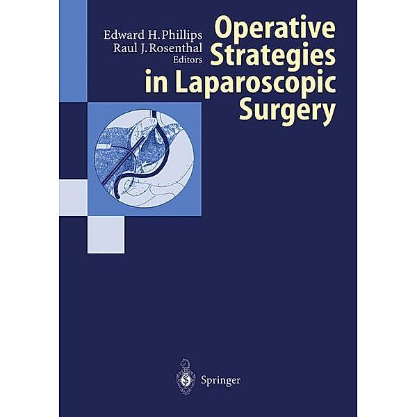 Operative Strategies in Laparoscopic Surgery