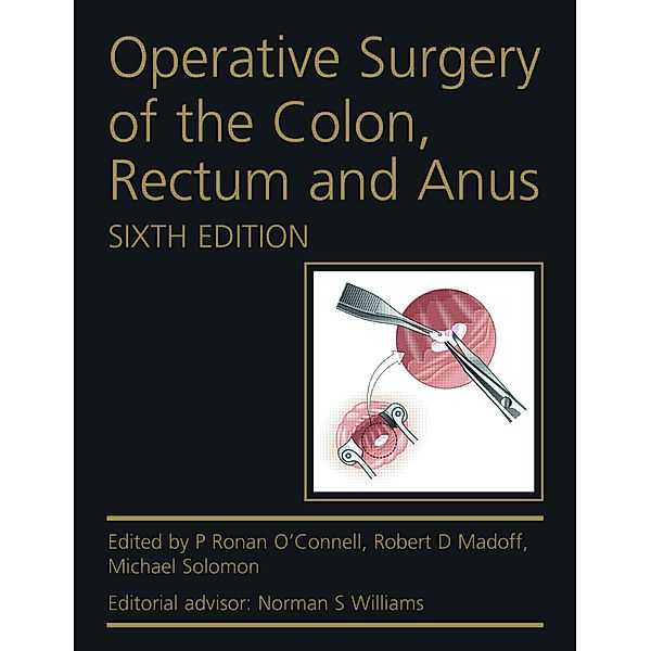 Operative Surgery of the Colon, Rectum and Anus, P Ronan O'Connell, Robert D. Madoff, Michael Solomon