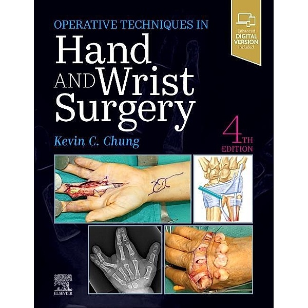 Operative Techniques: Hand and Wrist Surgery, Kevin C. Chung