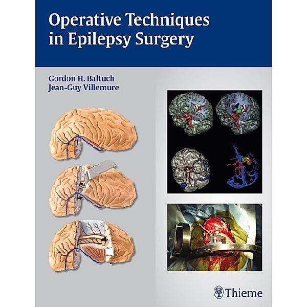 Operative Techniques in Epilepsy Surgery, Gordon H. Baltuch, Jean-Guy Villemure