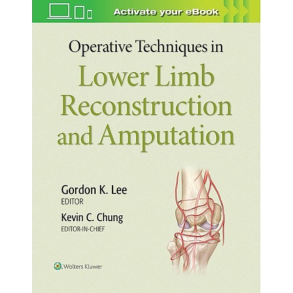 Operative Techniques in Lower Limb  Reconstruction and Amputation