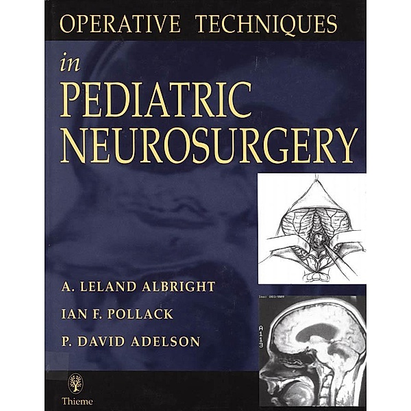 Operative Techniques in Pediatric Neurosurgery, A. Leland Albright, Ian F. Pollack, P. David Adelson