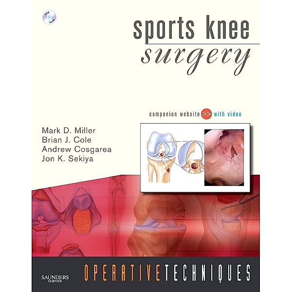 Operative Techniques: Operative Techniques: Sports Knee Surgery E-Book, Mark D. Miller, Brian J. Cole, Jon K. Sekiya, Andrew Cosgarea