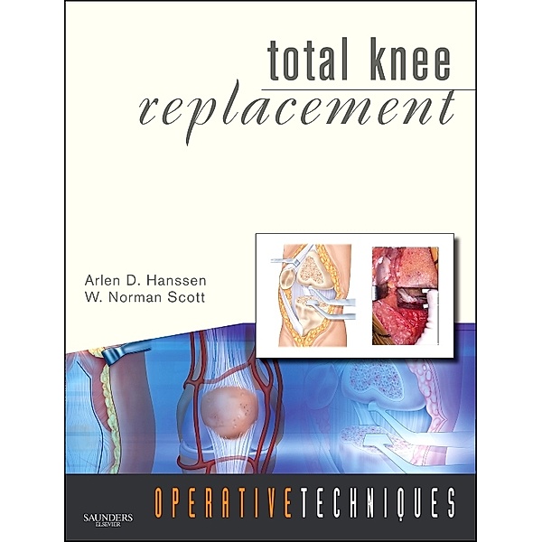 Operative Techniques: Operative Techniques: Total Knee Replacement E-Book, Arlen D. Hanssen, W. Norman Scott