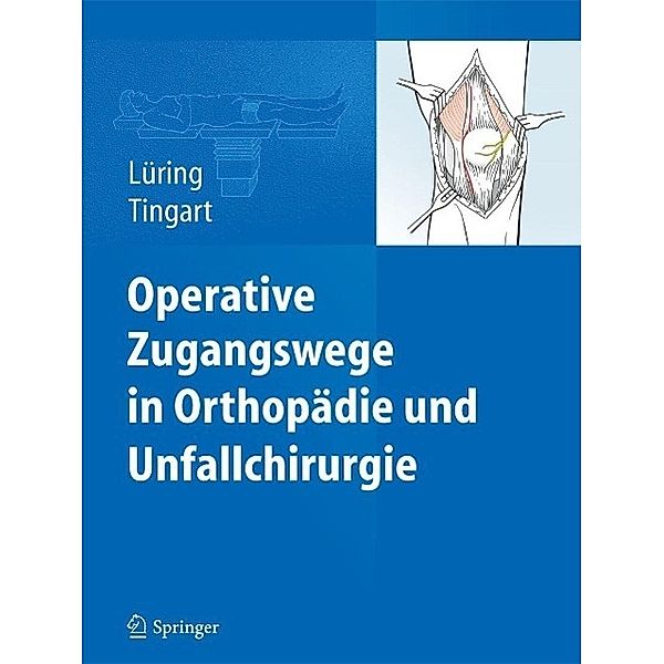 Operative Zugangswege in Orthopädie und Unfallchirurgie