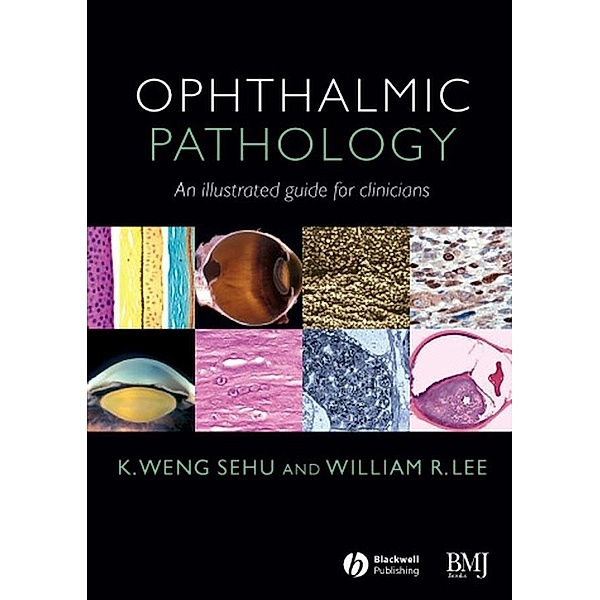 Ophthalmic Pathology, K. Weng Sehu, William R. Lee