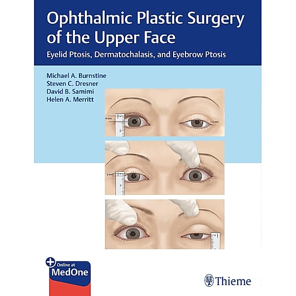Ophthalmic Plastic Surgery of the Upper Face, Michael A. Burnstine, Steven C. Dresner, David B. Samimi, Helen A. Merritt