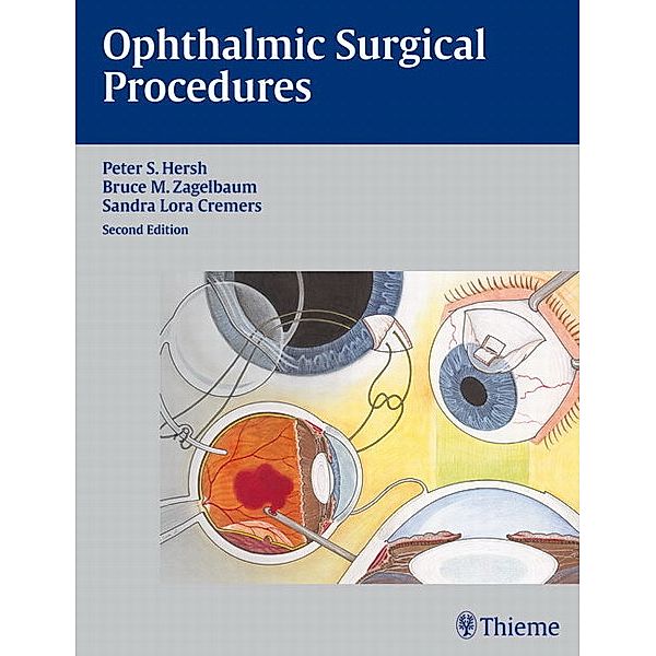 Ophthalmic Surgical Procedures, Peter S. Hersh, Bruce M. Zagelbaum, Sandra L. Cremers