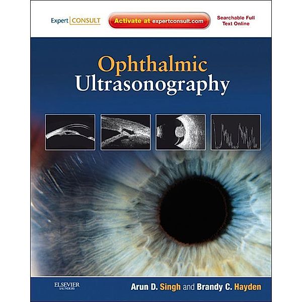 Ophthalmic Ultrasonography E-Book, Arun D. Singh, Brandy H. Lorek