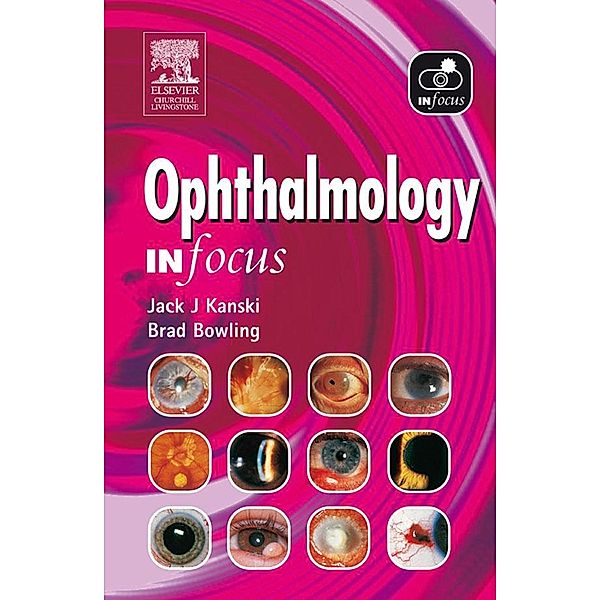 Ophthalmology In Focus, Jack J. Kanski, Brad Bowling