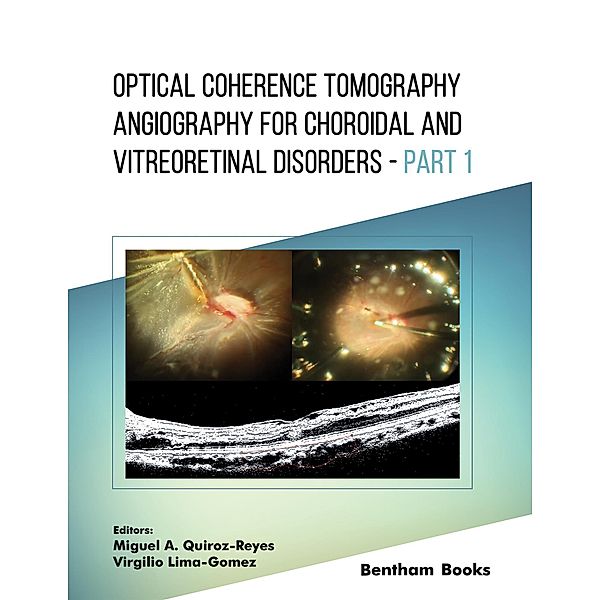 Optical Coherence Tomography Angiography for Choroidal and Vitreoretinal Disorders - Part 1