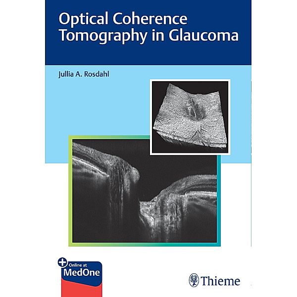Optical Coherence Tomography in Glaucoma, Jullia Rosdahl