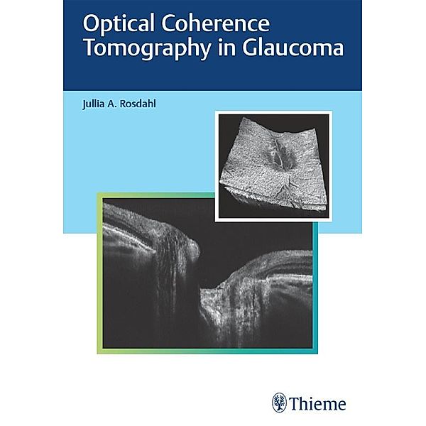 Optical Coherence Tomography in Glaucoma, Jullia A. Rosdahl