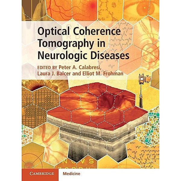 Optical Coherence Tomography in Neurologic Diseases