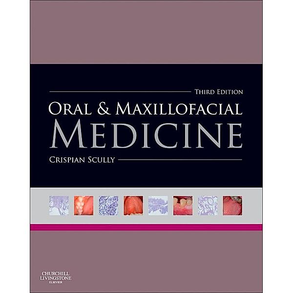 Oral and Maxillofacial Medicine, Crispian Scully