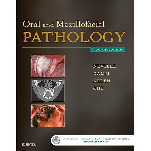 Oral and Maxillofacial Pathology - E-Book, Brad W. Neville, Douglas D. Damm, Carl M. Allen, Angela C. Chi