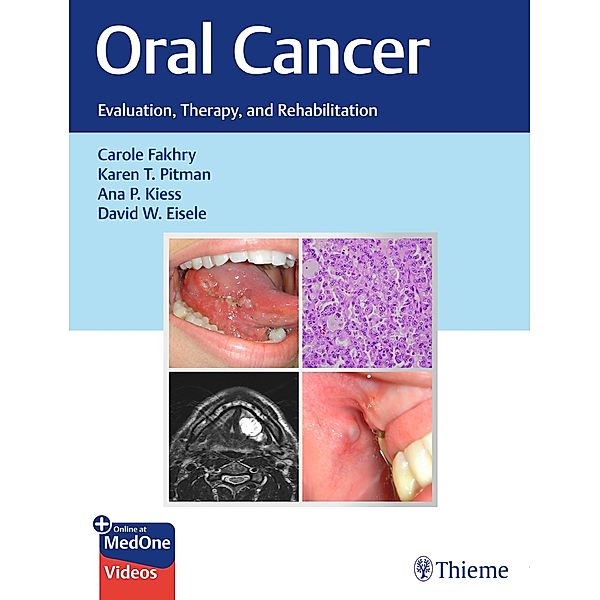 Oral Cancer, Carole Fakhry, Karen T. Pitman, Ana P. Kiess, David W. Eisele