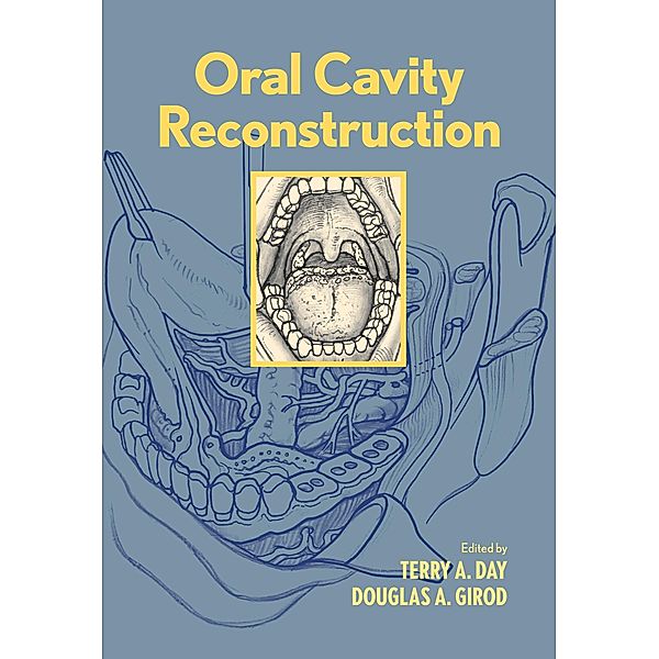 Oral Cavity Reconstruction