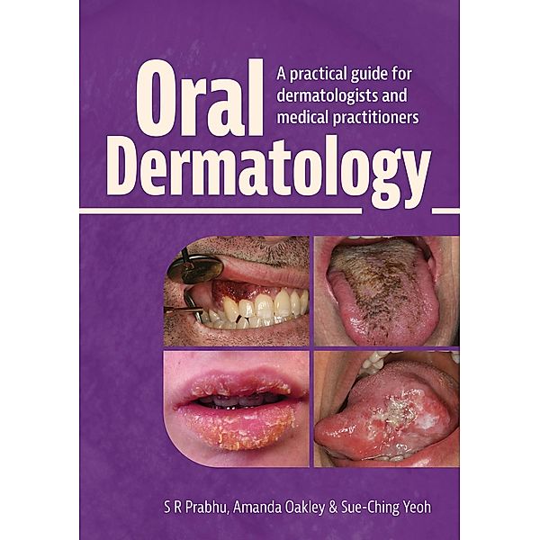 Oral Dermatology, S. R. Prabhu, Amanda Oakley, Sue-Ching Yeoh