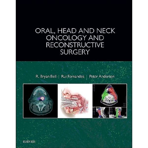 Oral, Head and Neck Oncology and Reconstructive Surgery, R. Bryan Bell, Peter A. Andersen, Rui P. Fernandes