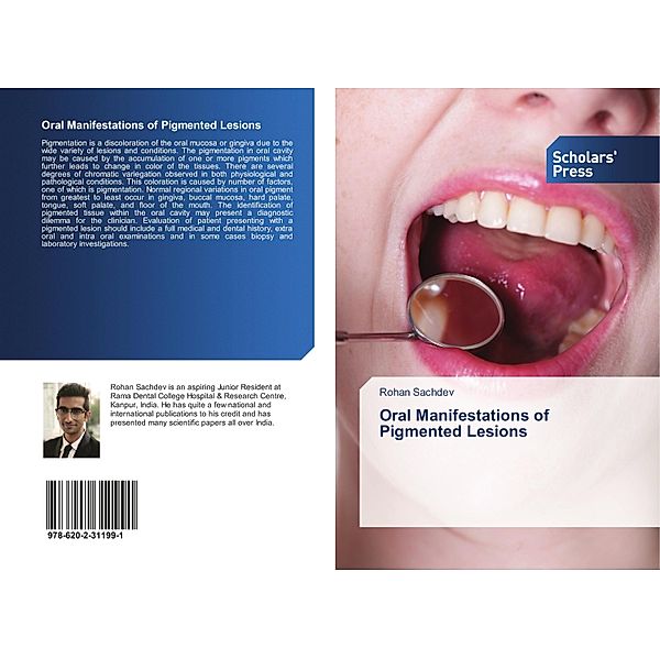 Oral Manifestations of Pigmented Lesions, Rohan Sachdev