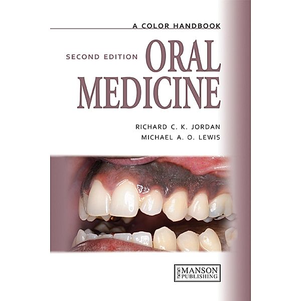 Oral Medicine, Michael Lewis, Richard Jordan
