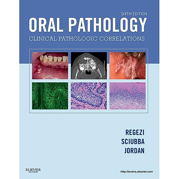 Oral Pathology - E-Book, Joseph A. Regezi, James Sciubba, Richard C. K. Jordan