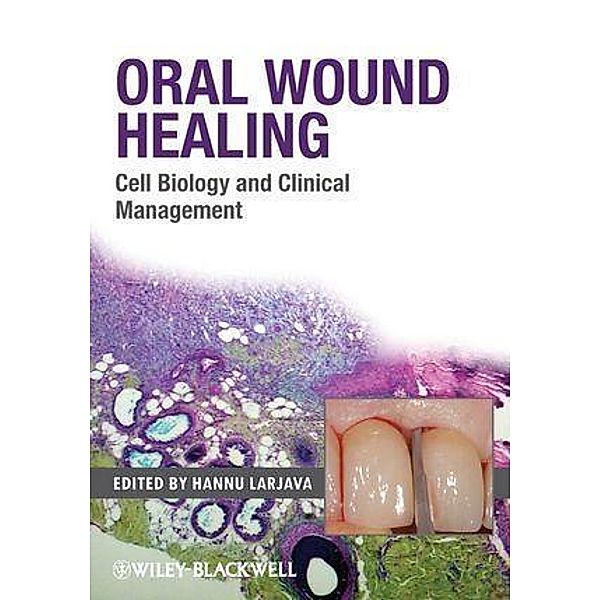 Oral Wound Healing