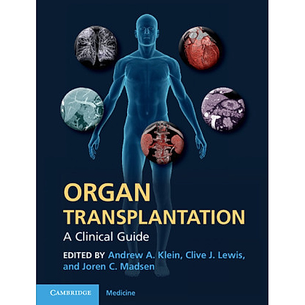 Organ Transplantation, Andrew Madsen Klein