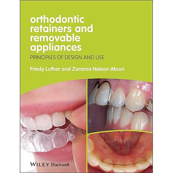 Orthodontic Retainers and Removable Appliances, Friedy Luther, Zararna Nelson-Moon