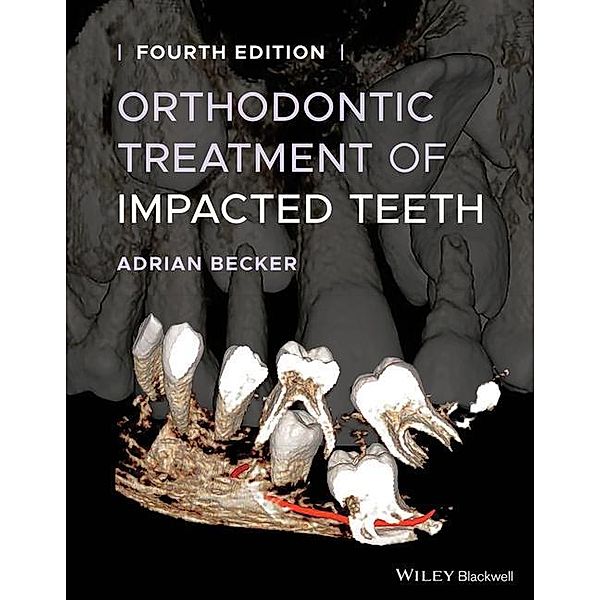 Orthodontic Treatment of Impacted Teeth, Adrian Becker