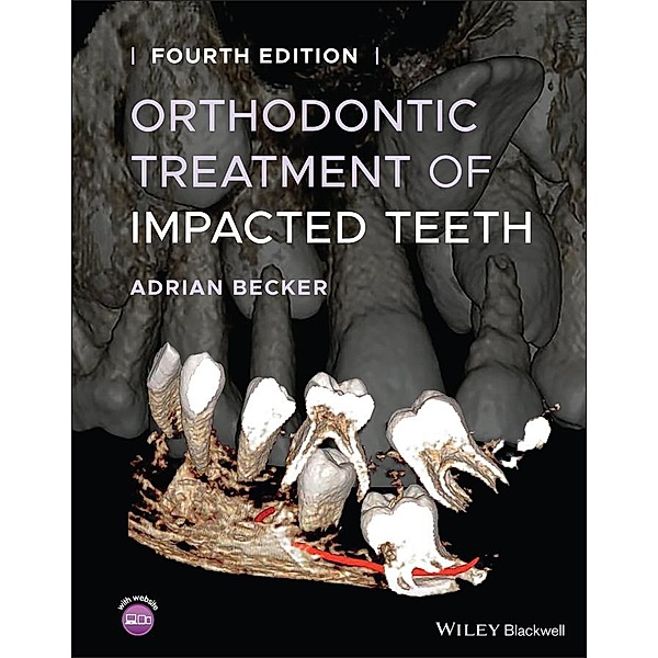 Orthodontic Treatment of Impacted Teeth, Adrian Becker