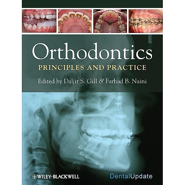 Orthodontics, Daljit S. Gill, Farhad B. Naini
