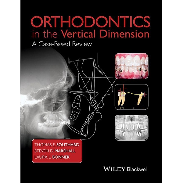 Orthodontics in the Vertical Dimension, Thomas E. Southard, Steven D. Marshall, Laura L. Bonner