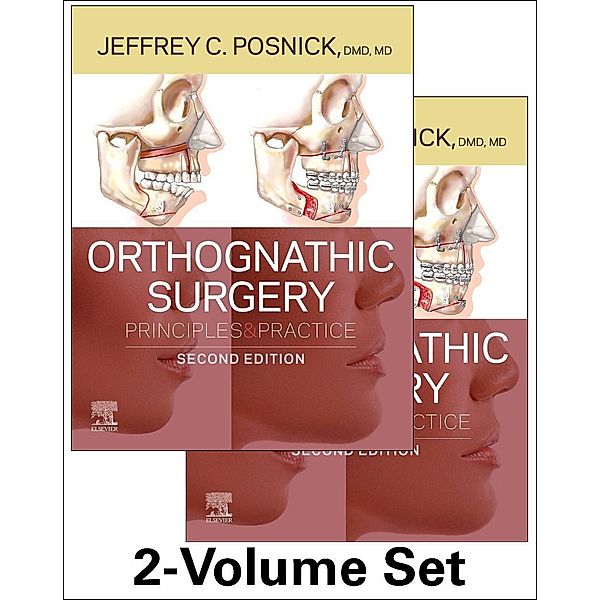Orthognathic Surgery - 2 Volume Set, Jeffrey C. Posnick